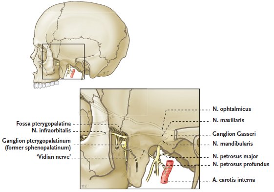  بلاک گانگلیون اسفنوپالاتین (sphenopalatine ganglion block)